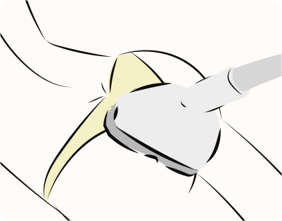 CLATUUα（クラツーアルファ）