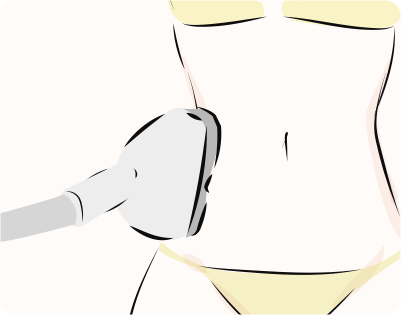 CLATUUα（クラツーアルファ）