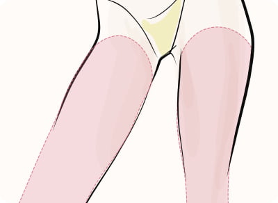 脂肪吸引（足）（ベイザー・アキーセル）
