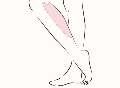 ボトックス注入