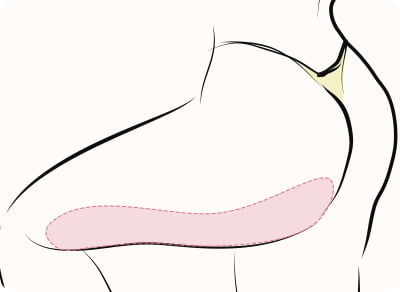 アクセントプライム